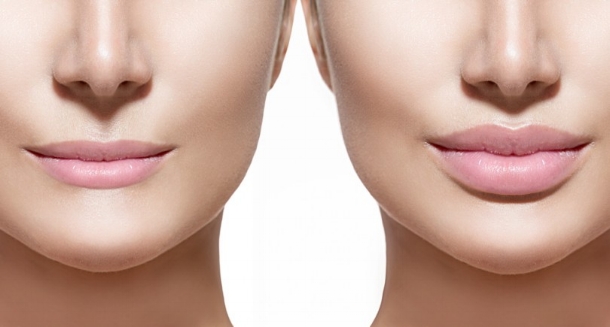 Is half a syringe of Juvederm enough for lips?